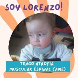 “Todos por Lolo”: necesita un tratamiento urgente antes de llegar a los dos años